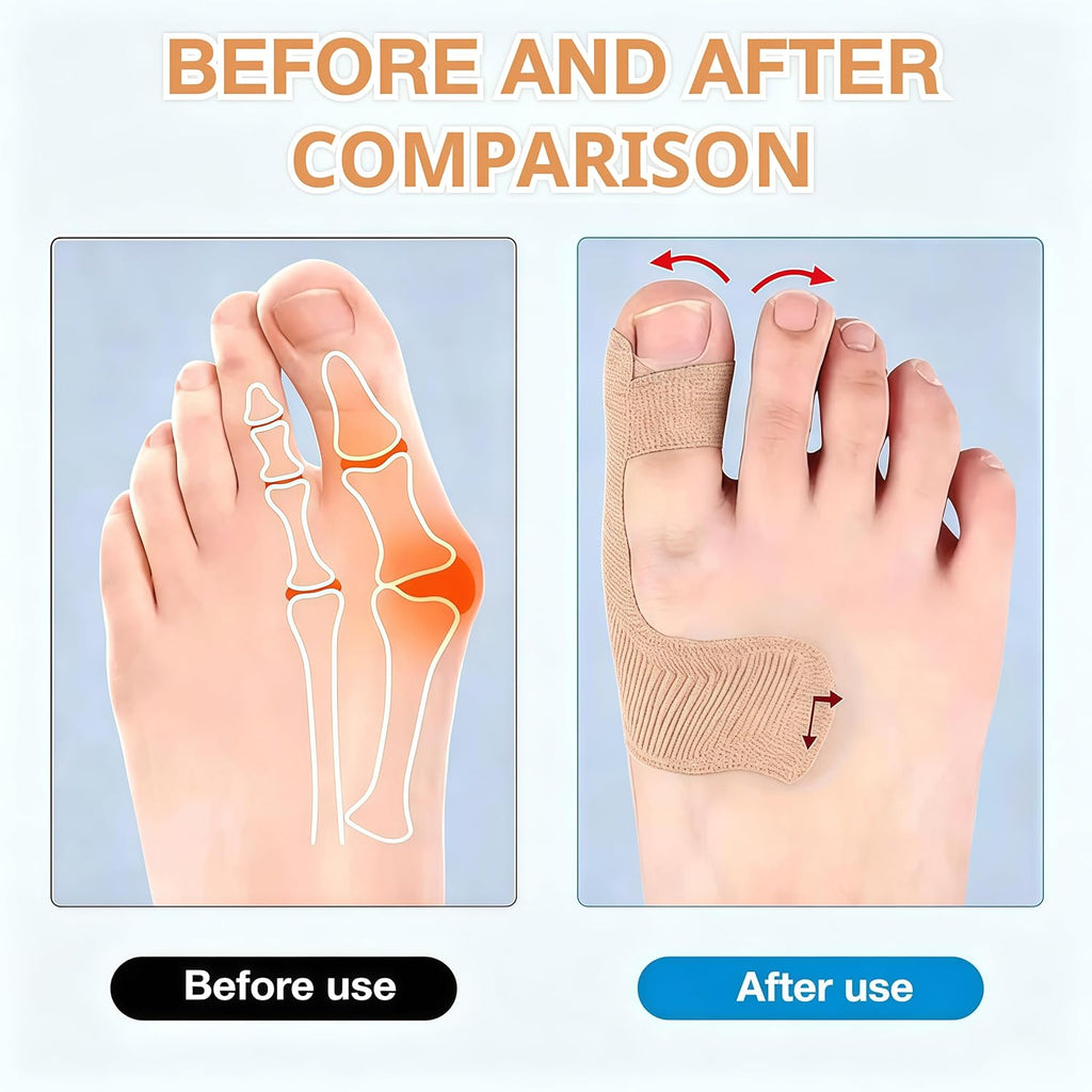 Bunion Corrector Kinesiology Tape - Precut Elastic Support for Big Toe